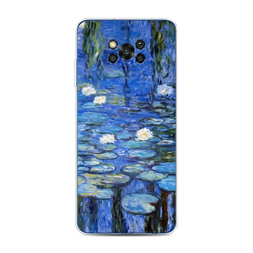 Чехол для Xiaomi Poco X3/Poco X3 Pro "Нарисованный пруд", Синий;зеленый, 39250-4
Чехол для Xiaomi Poco X3/Poco X3 Pro "Нарисованный пруд", Синий;зеленый, 39250-4
