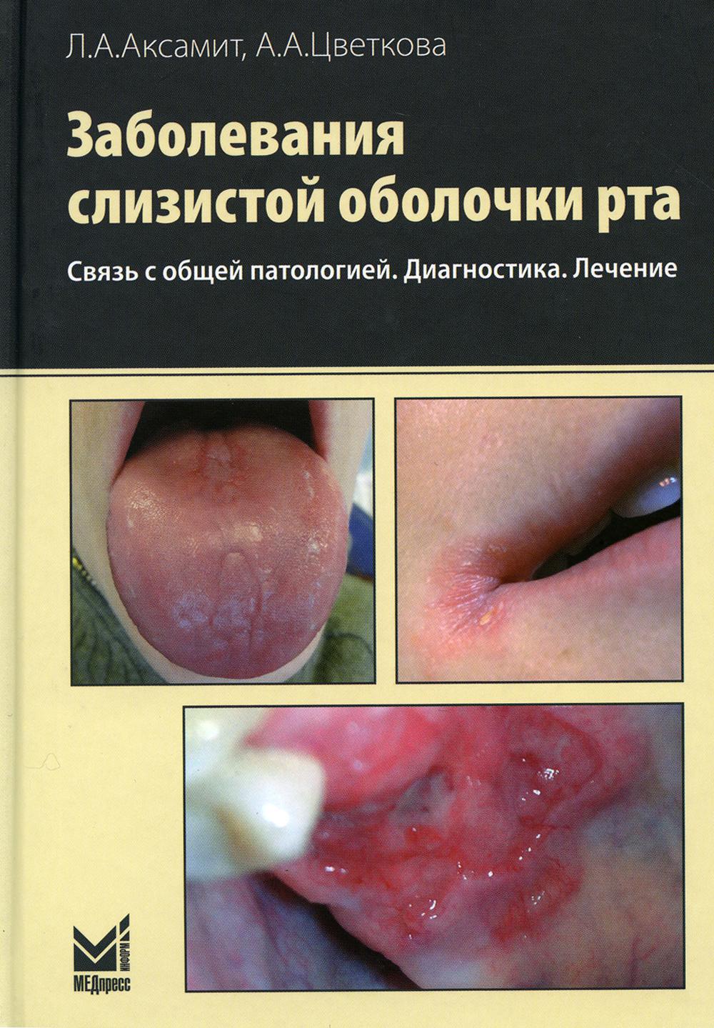 Книга Заболевания слизистой оболочки рта. Связь с общей патологией. Диагностика. Лечени...
Книга Заболевания слизистой оболочки рта. Связь с общей патологией. Диагностика. Лечени...