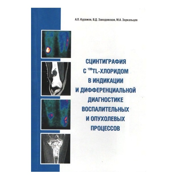 Книга Сцинтиграфия с 199TL-хлоридом в индикации и дифференциальной диагностике воспалит...
Книга Сцинтиграфия с 199TL-хлоридом в индикации и дифференциальной диагностике воспалит...