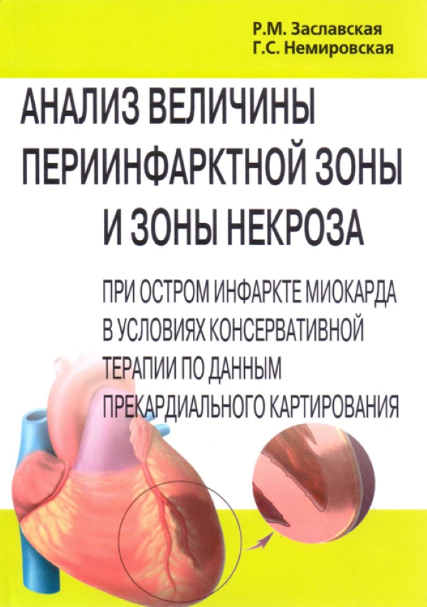 Анализ величины периинфарктной зоны и зоны некроза при остром инфаркте миокарда в...
Анализ величины периинфарктной зоны и зоны некроза при остром инфаркте миокарда в...