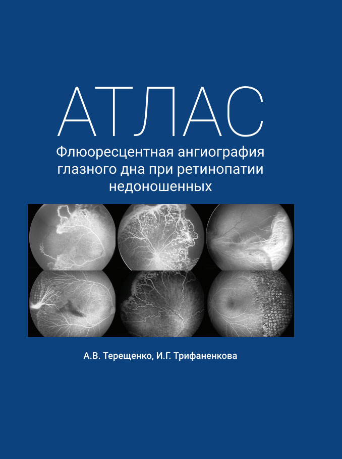 Атлас Флюоресцентная ангиография глазного дна при ретинопатии недоношенных Терещенко
Атлас Флюоресцентная ангиография глазного дна при ретинопатии недоношенных Терещенко