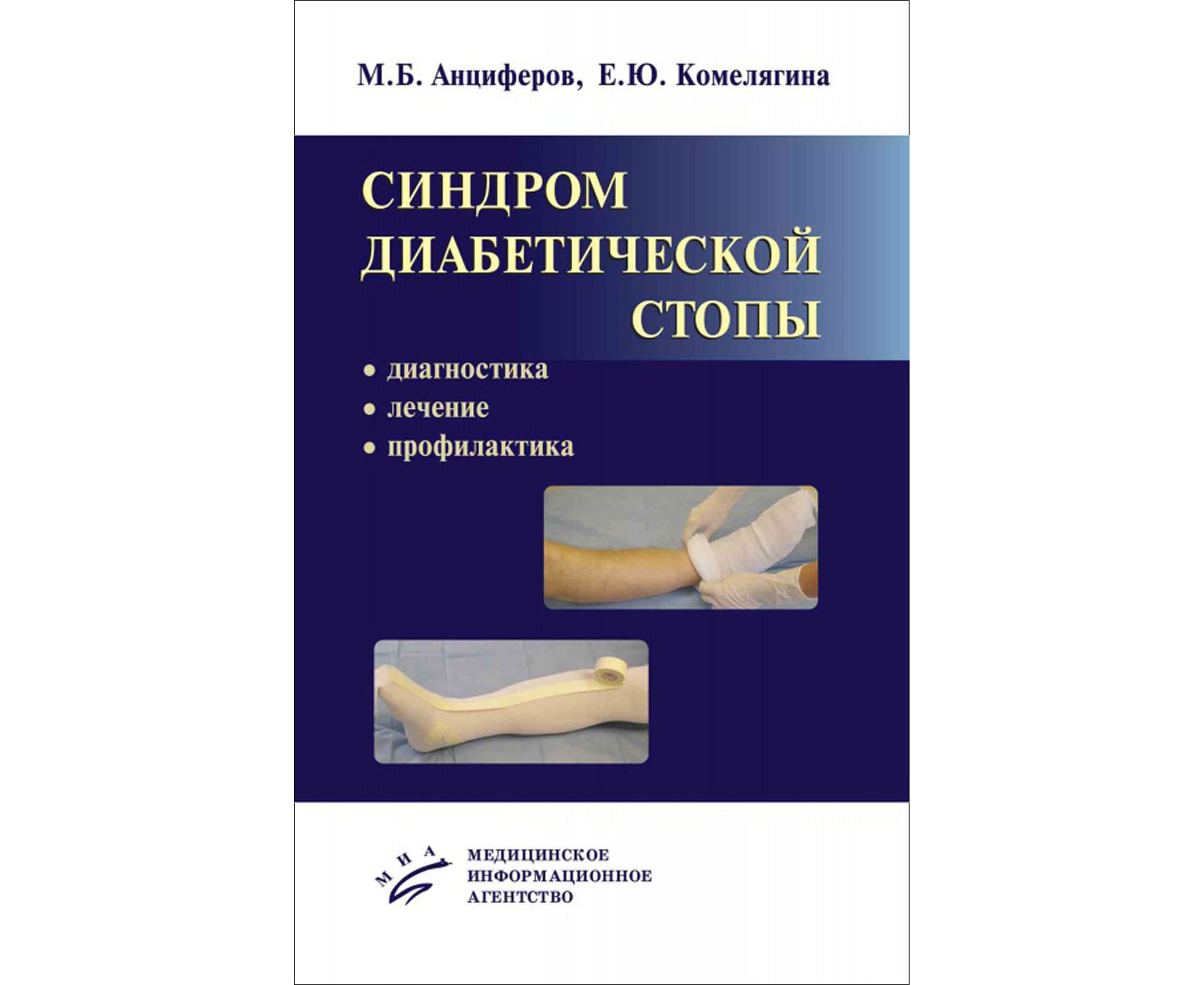 Книга Синдром диабетической стопы: диагностика, лечение и профилактика / Анциферов М.Б....
Книга Синдром диабетической стопы: диагностика, лечение и профилактика / Анциферов М.Б....