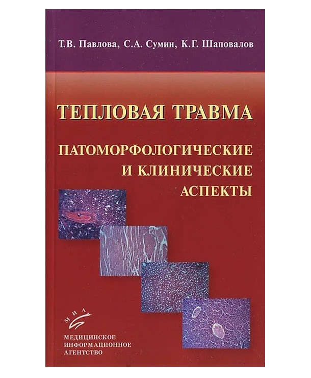 Книга Тепловая травма: патоморфологические и клинические аспекты. -М. / Павлова Т.В., С...
Книга Тепловая травма: патоморфологические и клинические аспекты. -М. / Павлова Т.В., С...