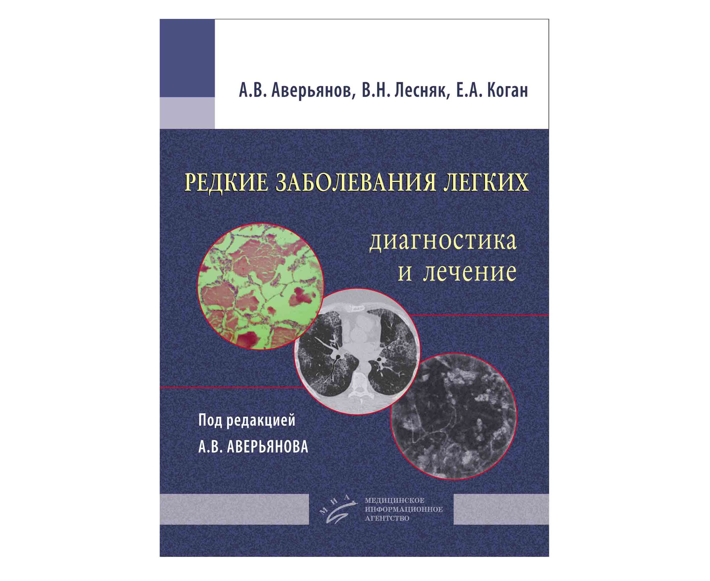 Книга Редкие заболевания легких: диагностика и лечение / Аверьянов А.В., Лесняк В.Н., К...
Книга Редкие заболевания легких: диагностика и лечение / Аверьянов А.В., Лесняк В.Н., К...