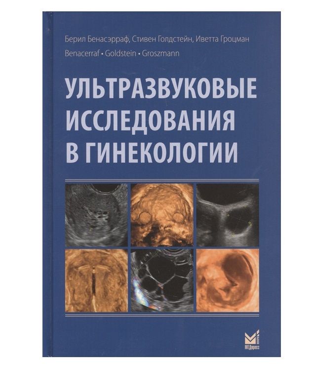 Книга Ультразвуковые исследования в гинекологии / Бенасэрраф Б., Голдстейн С., Гроцман И.
Книга Ультразвуковые исследования в гинекологии / Бенасэрраф Б., Голдстейн С., Гроцман И.