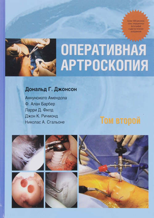 фото Книга оперативная артроскопия в 2-х томах. том 2 издательство панфилова