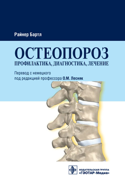 фото Книга остеопороз гэотар-медиа