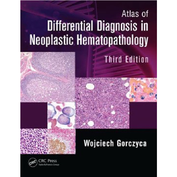 Atlas of Differential Diagnosis in Neoplastic Hematopathology, Third Edition / Gorczyca
Atlas of Differential Diagnosis in Neoplastic Hematopathology, Third Edition / Gorczyca