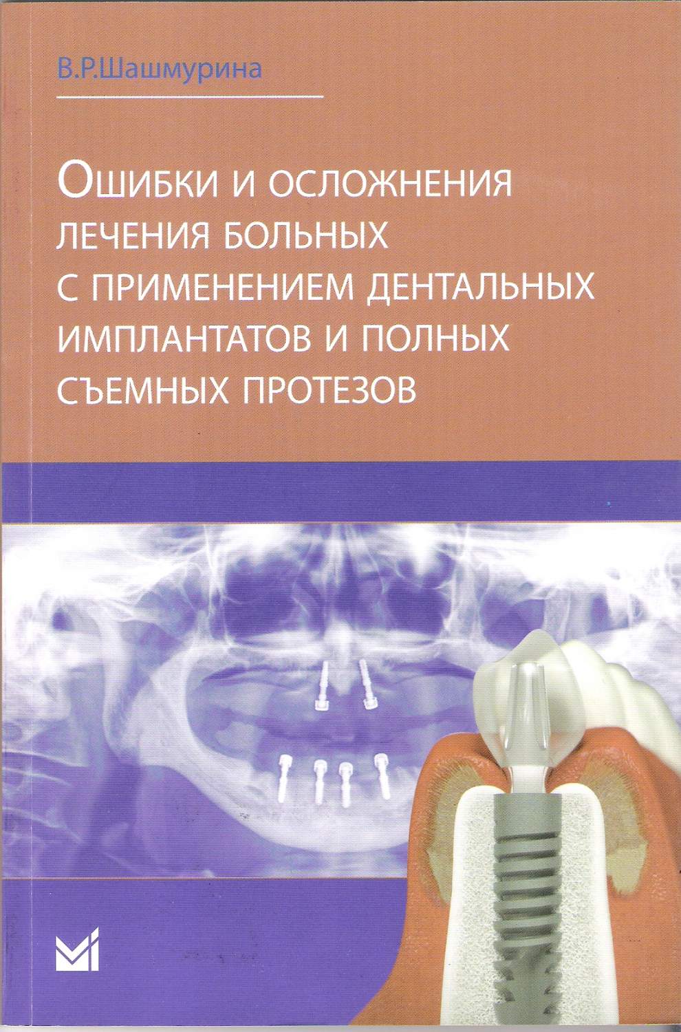 Книга Ошибки и осложнения лечения больных с применением дентальных - купить  здравоохранения, медицины в интернет-магазинах, цены на Мегамаркет | 7067173