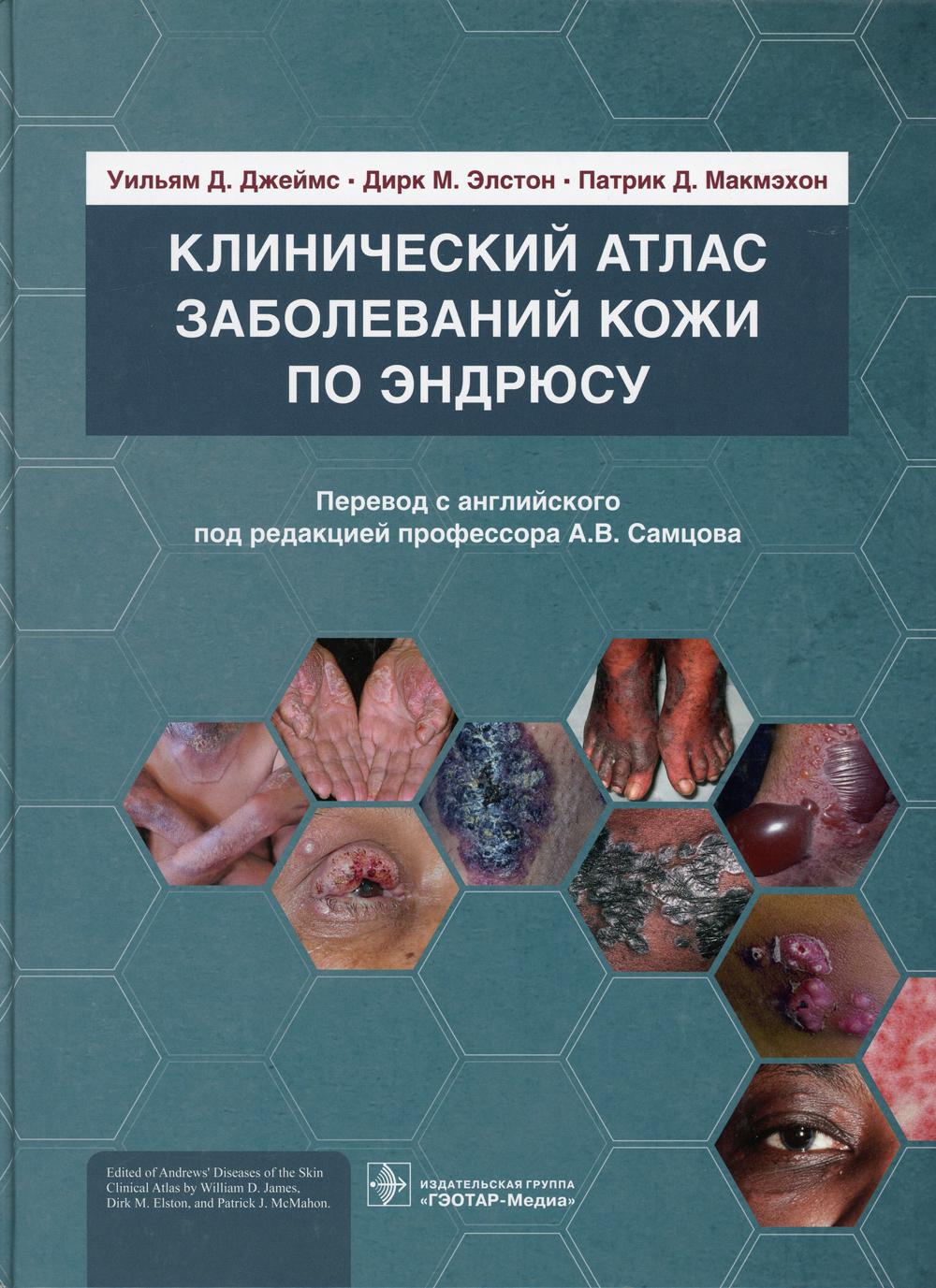 Клинический атлас заболеваний кожи по Эндрюсу - купить спорта, красоты и  здоровья в интернет-магазинах, цены на Мегамаркет | 9887260