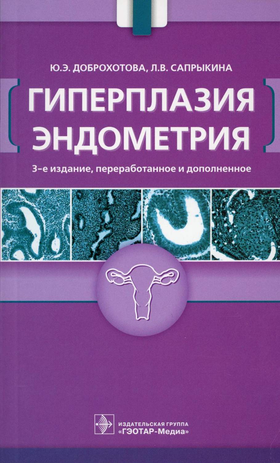 Книга Гиперплазия эндометрия. 3-е изд., перераб. и доп - купить спорта,  красоты и здоровья в интернет-магазинах, цены на Мегамаркет | 9888410