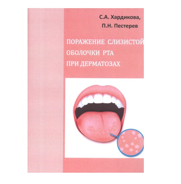 Нарушение слизистой. Поражение слизистой оболочки рта при дерматозах: учебное пособие. Эритроплакия слизистой оболочки рта. Заболевания слизистой оболочки полости. Воспалительные заболевания слизистой оболочки полости рта.