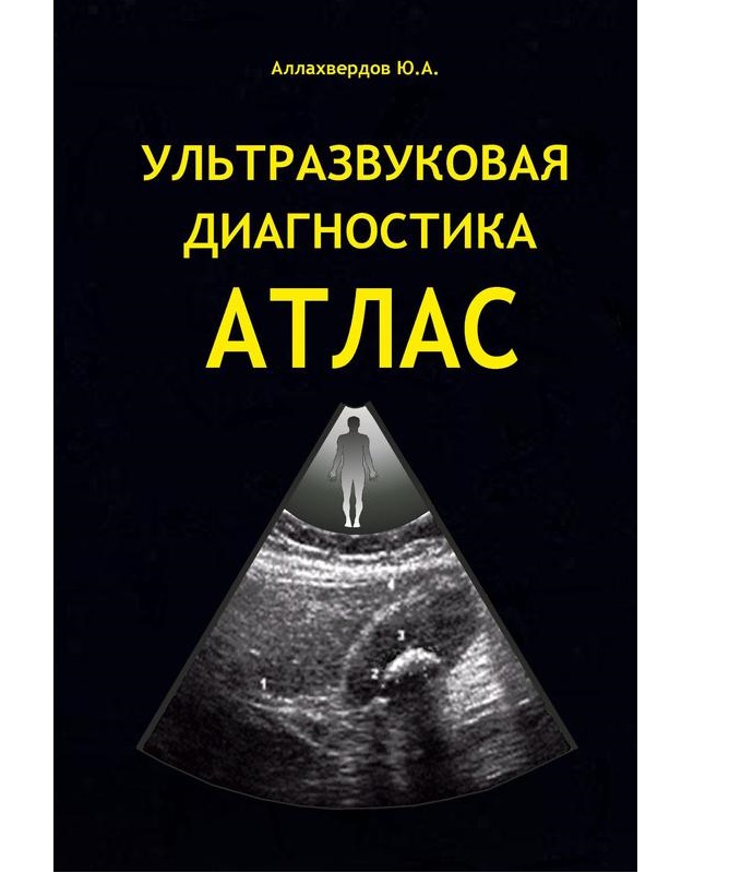 Атлас ультразвуковой диагностики / Аллахвердов Ю.А. - купить ...