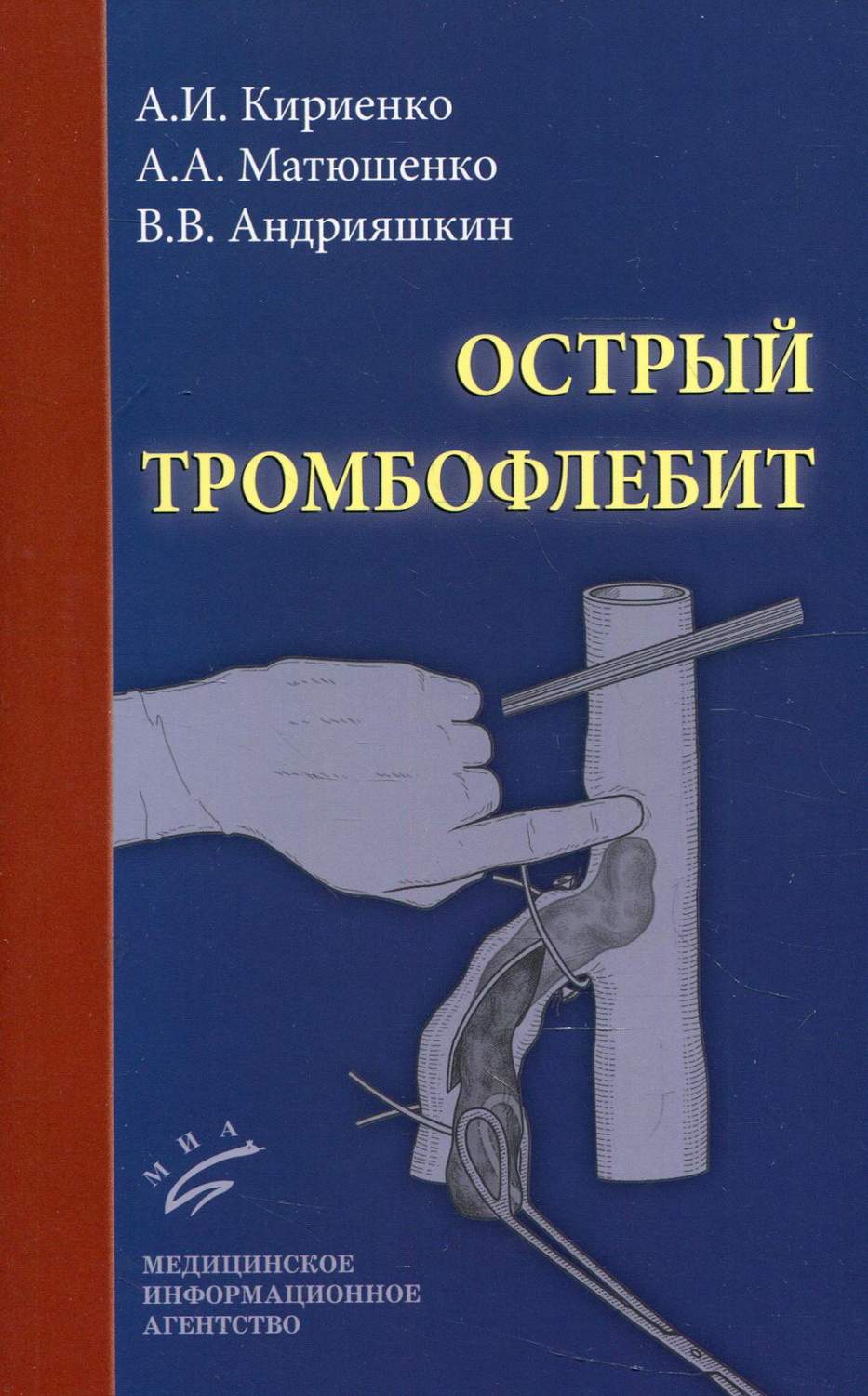 Острый тромбофлебит 2-е изд., перераб. и доп. - купить спорта, красоты и  здоровья в интернет-магазинах, цены на Мегамаркет | 10191400