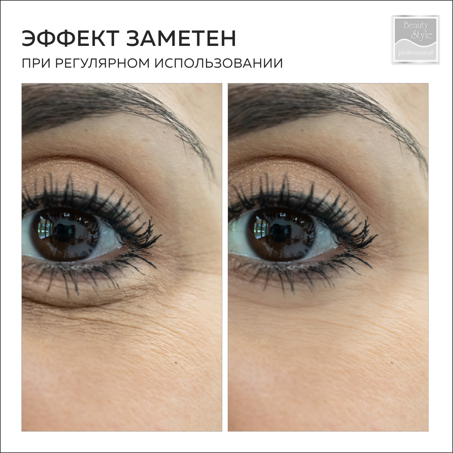 Приклеенные красота: патчи — самый востребованный бьюти-тренд