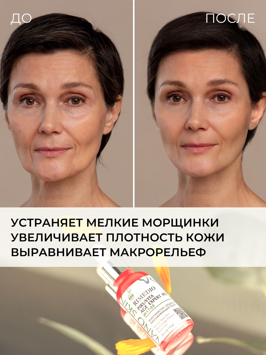 Пировиноградный Пилинг Для Лица Купить