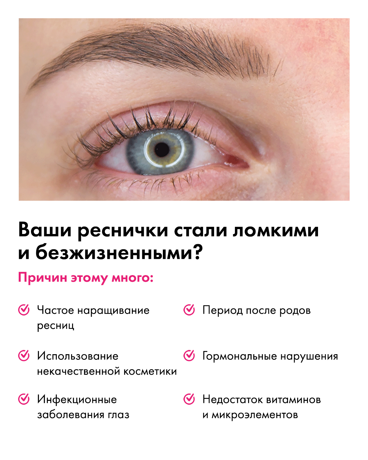 Сыворотка для роста ресниц и бровей Toplash Lash and Brow booster - отзывы  покупателей на Мегамаркет | средства для роста бровей и ресниц top-101