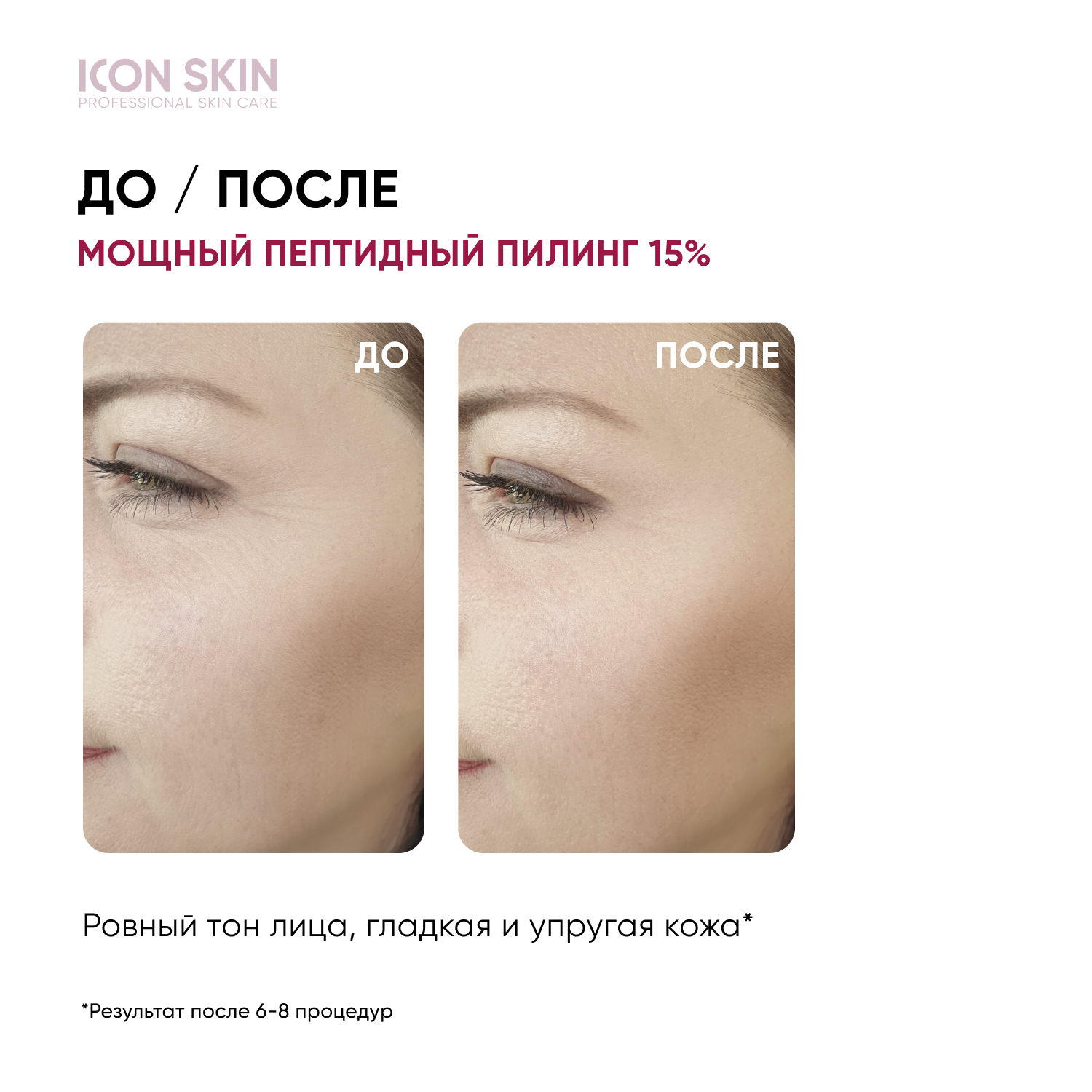 Пептидный пилинг отзывы. Крем icon Skin. Пилинг Айкон скин. Evolution крем для лица. Icon Skin отзывы.