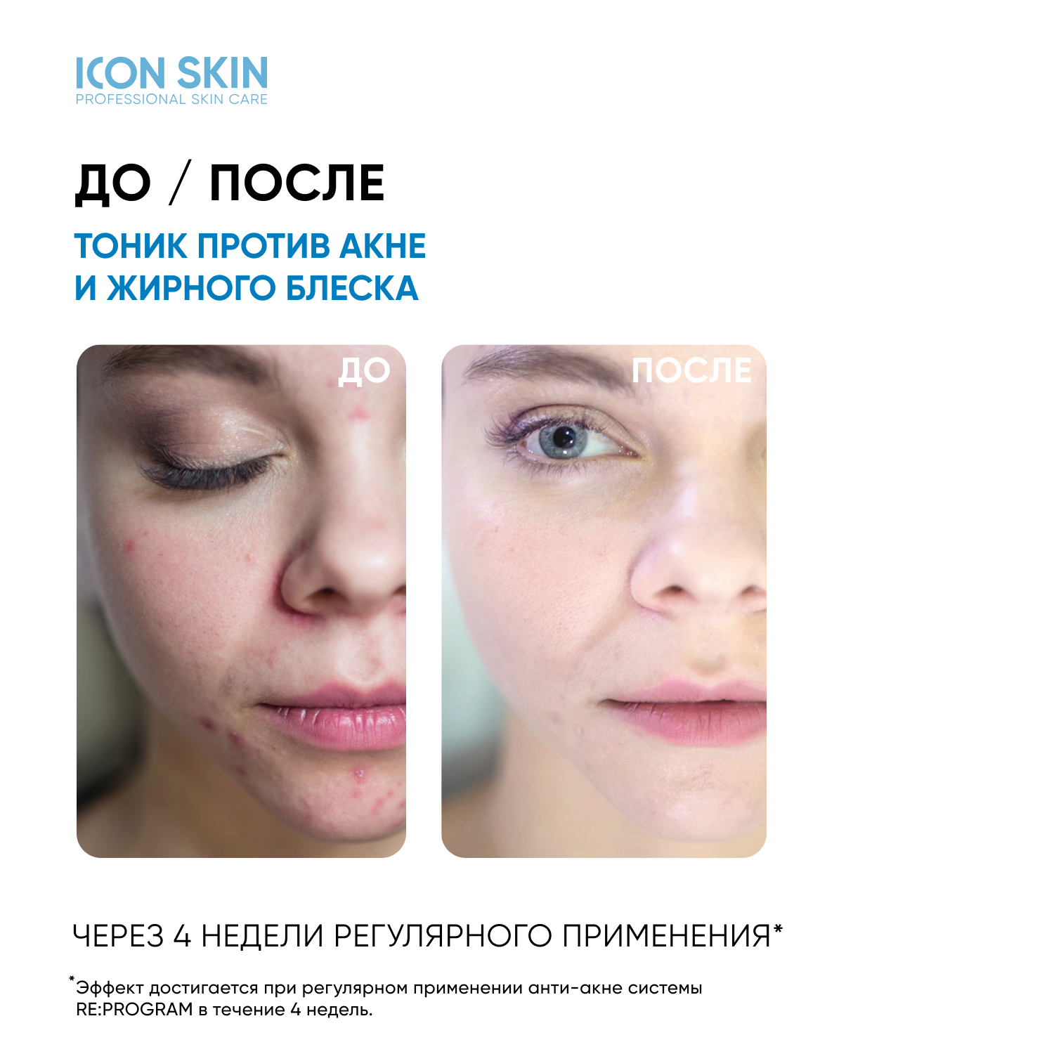 Icon skin отзывы. Icon Skin сыворотка-пилинг для лица. Icon Skin дневной флюид Matte & Care фото. Очищающая эмульсия nesens.