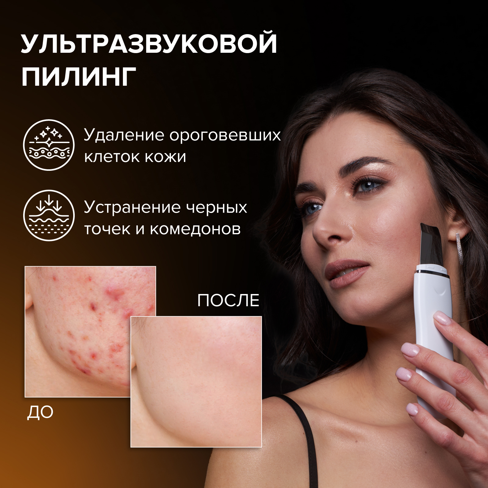 Скрабер для ультразвуковой чистки лица HoneyCare с лифтинг эффектом -  отзывы покупателей на Мегамаркет | приборы для ухода за лицом  skinscrubber-HC