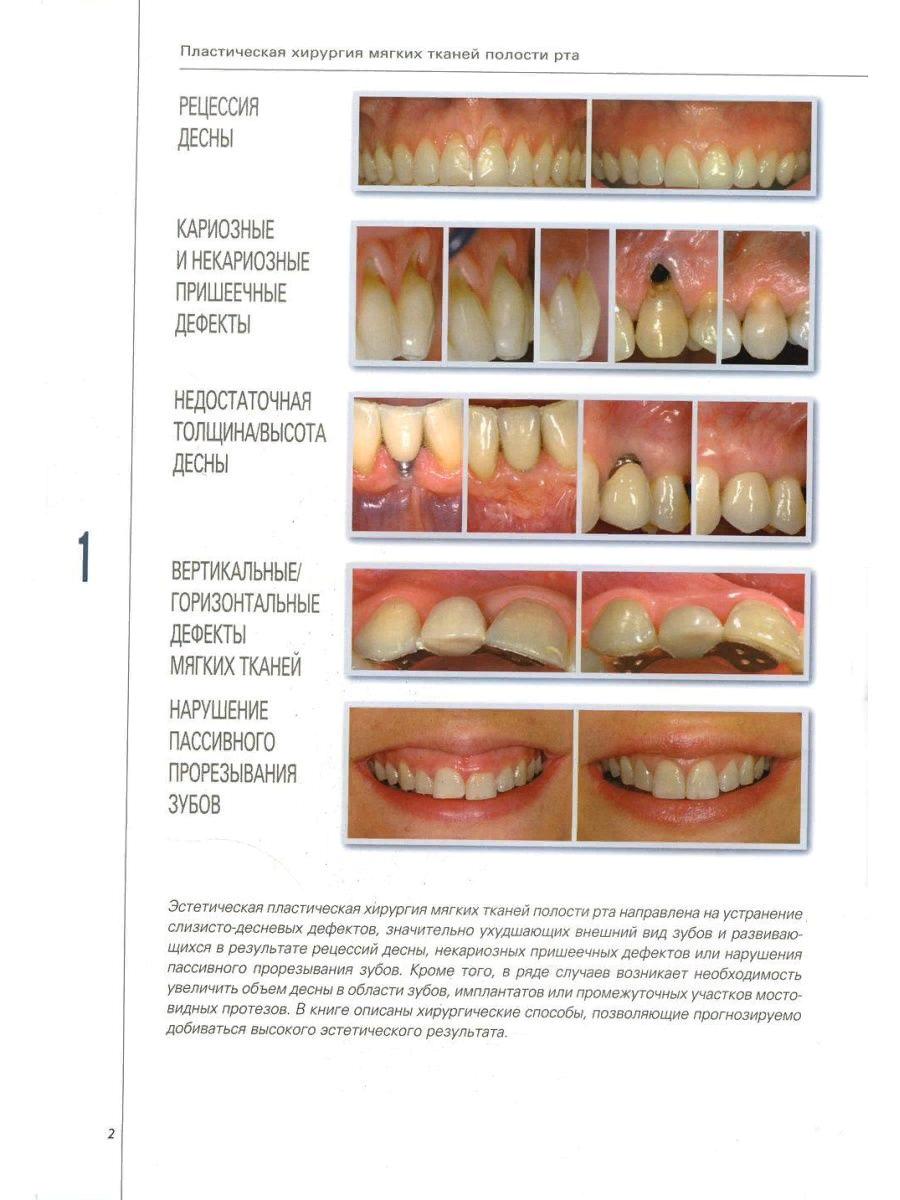 Пластическая хирургия мягких тканей полости рта - купить здравоохранения,  медицины в интернет-магазинах, цены на Мегамаркет | 978-5-91443-046-4