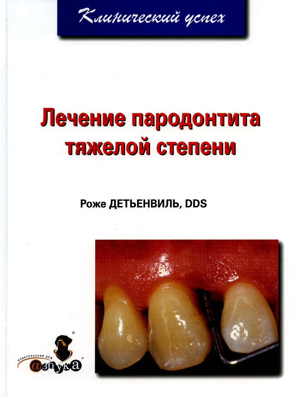 Лечение пародонтита тяжелой степени - купить в Торговый Дом БММ, цена на  Мегамаркет