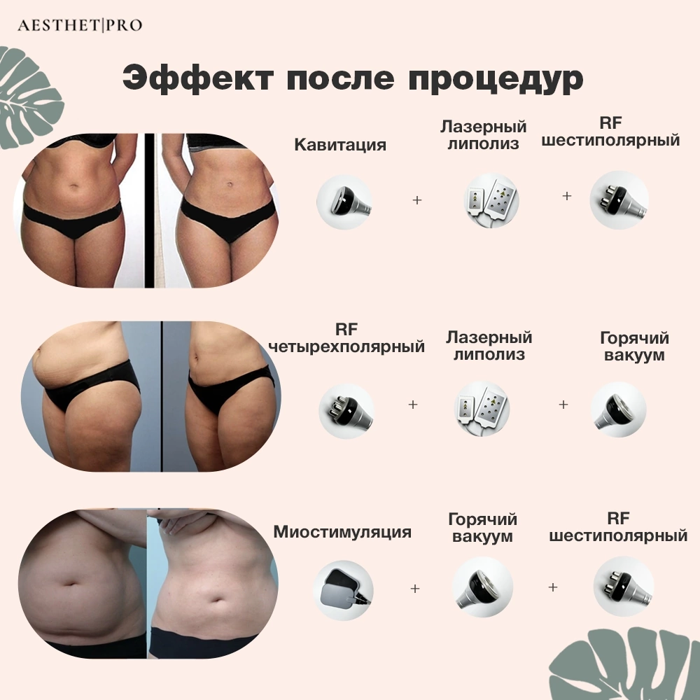 Купить косметологический аппарат AesthetPro Ким 8 10в1 для ухода за лицом и  коррекции фигуры, цены на Мегамаркет | Артикул: 600015874048