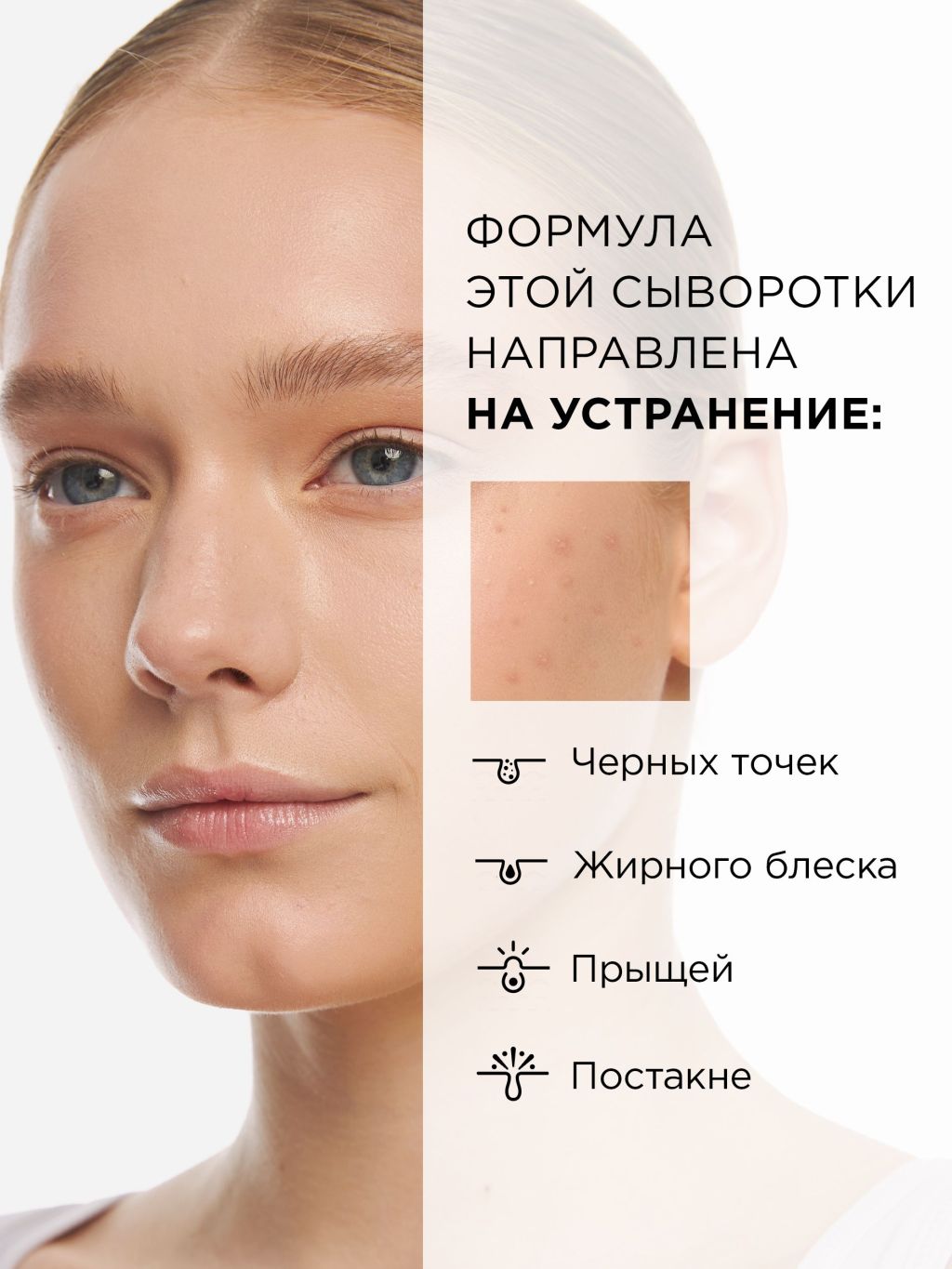 Купить сыворотка MIXIT Skin Chemistry Niacinamide 10% + Zinc 0,5% Serum, 30  мл, цены на Мегамаркет | Артикул: 100026934728