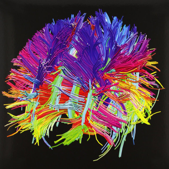 Себастьян сеунг. Проект коннектом. Коннектом отзывы. The 2nd law. Нейронные микросети.