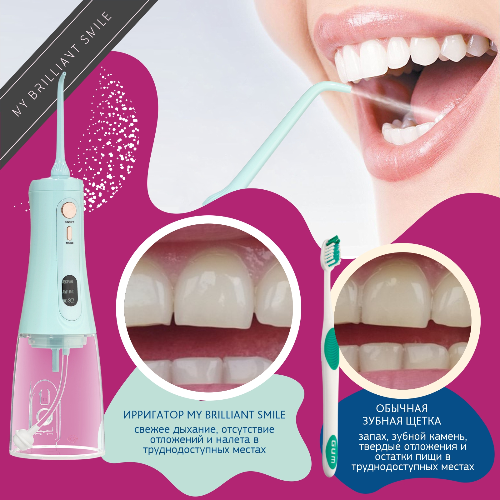 My brilliant smile отзывы