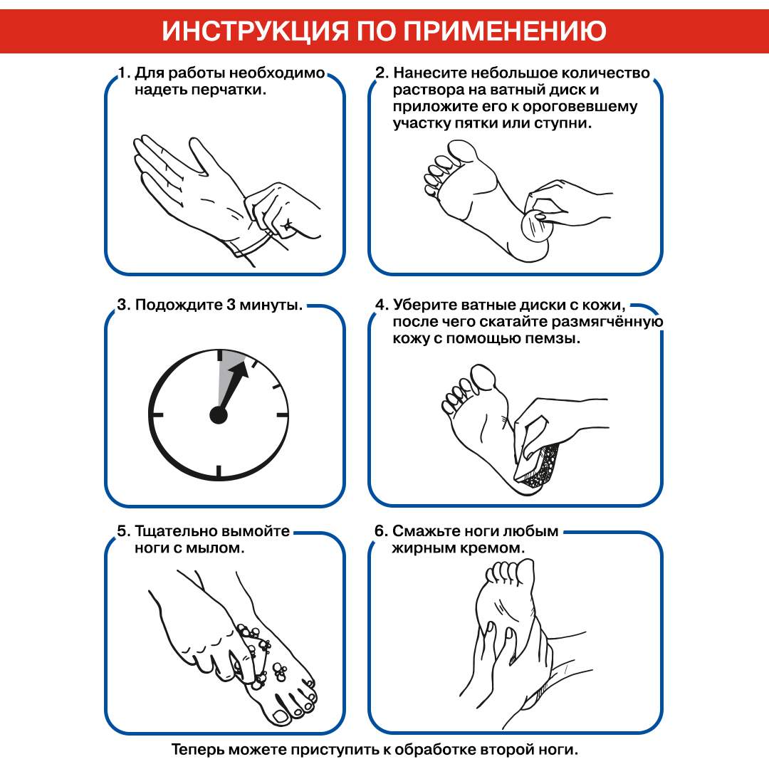 Набор Нанопятки Средство для пяток от трещин мозолей + пемза + Крем Заживит  - отзывы покупателей на Мегамаркет | наборы средств по уходу за телом  4100017