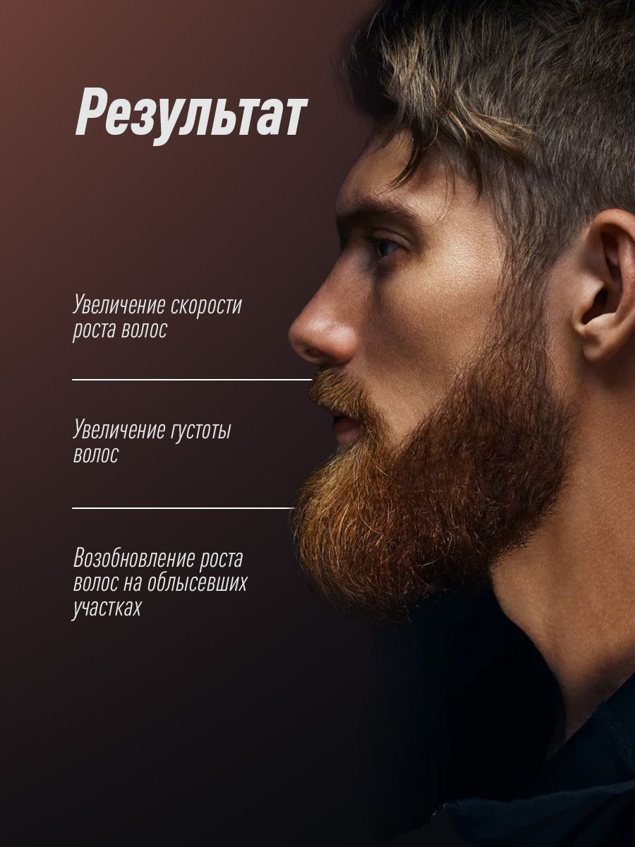 Купить миноксидил 1 флакон iiSolutions Minoxidil 15%, цены на Мегамаркет |  Артикул: 100043000952