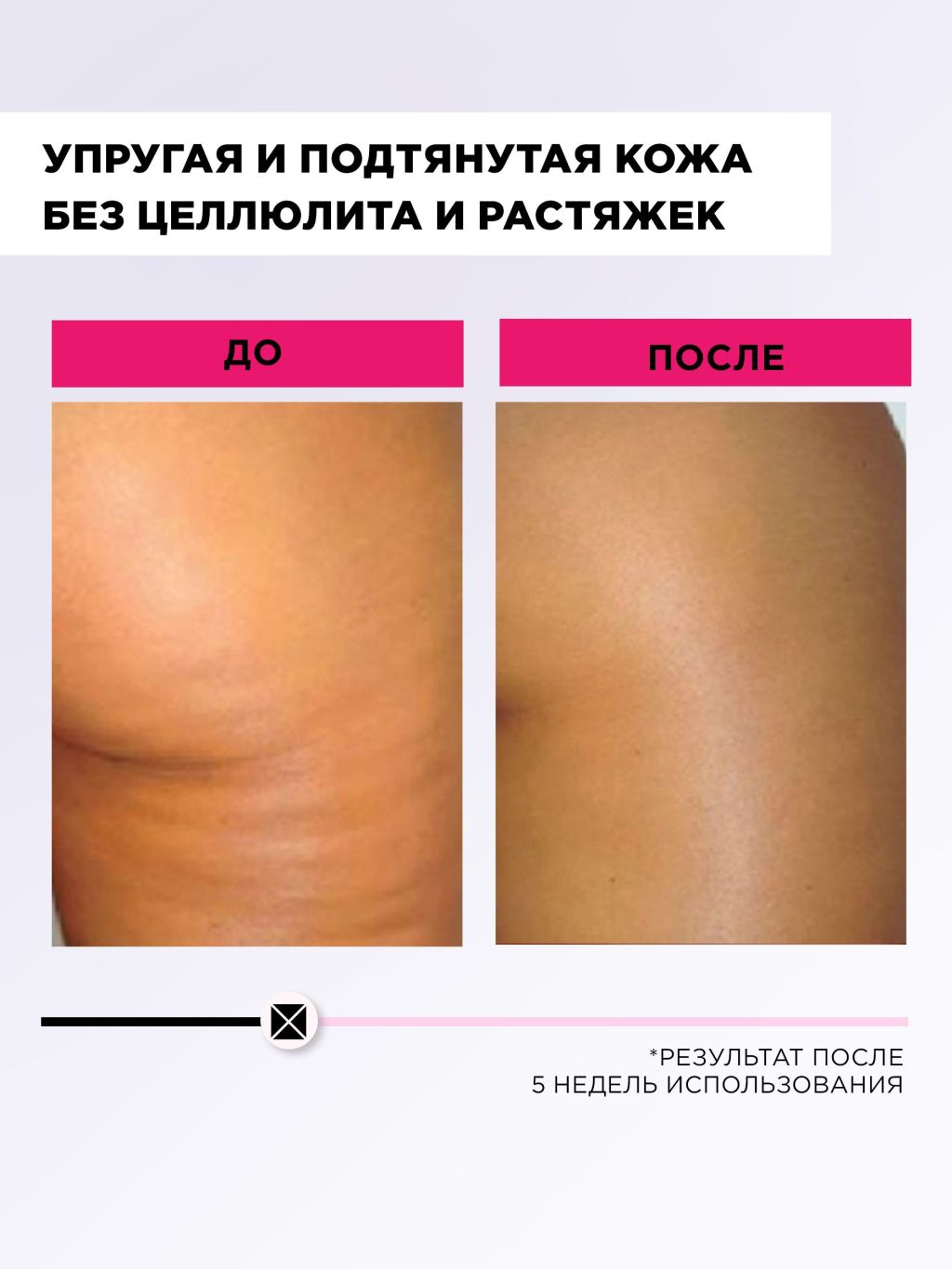 Обертывания антицеллюлитные миксит. Антицеллюлитное обертывание. Обертывания антицеллюлитные. Горячее обертывание от целлюлита. Эффективные обертывания от целлюлита