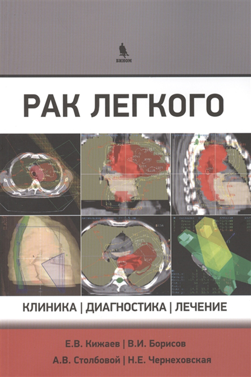 

Рак легкого, Клиника, диагностика, лечение