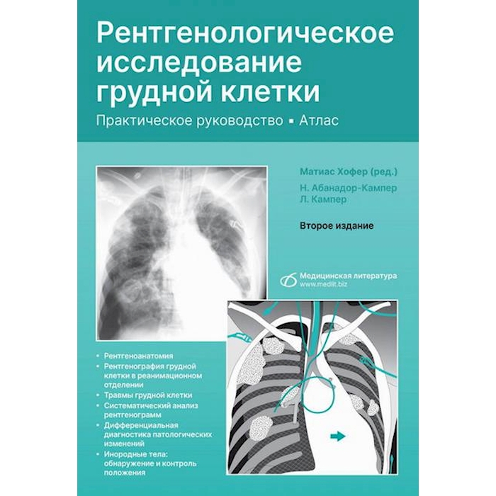 

Рентгенологическое исследование грудной клетки. Практическое руководство