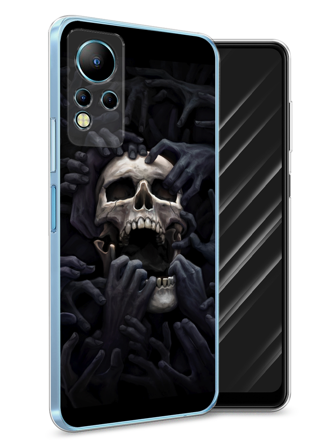 

Чехол Awog на Infinix Note 11 "Череп 29", Разноцветный, 3100450-9