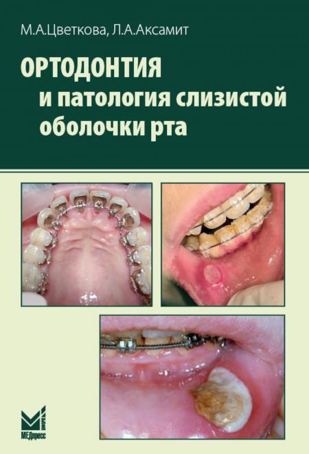 

Ортодонтия и патология слизистой оболочки рта