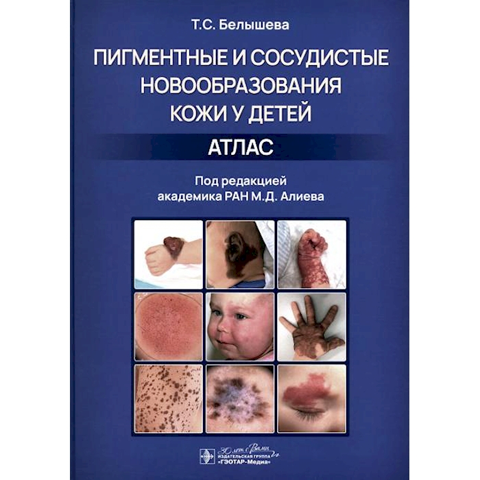 

Пигментные и сосудистые новообразования кожи у детей. Атлас