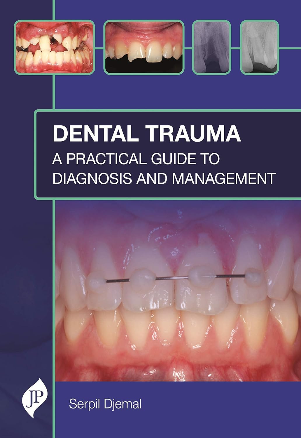 

Dental Trauma: A Practical Guide to Diagnosis and Management. Serpil Djemal