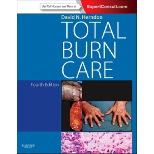 

Total Burn Care, / David N. Herndon