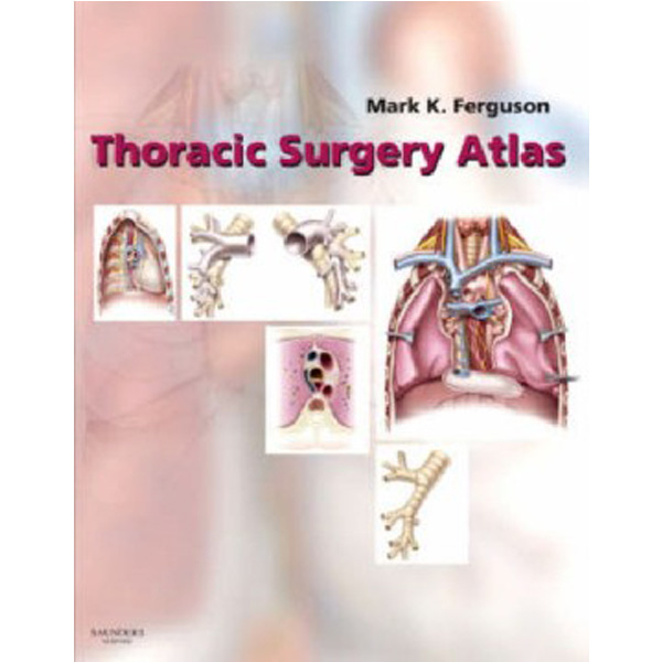 

Thoracic Surgery Atlas / Mark Ferguson