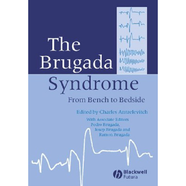 

The Brugada Syndrome.2005 / Antzelevitch