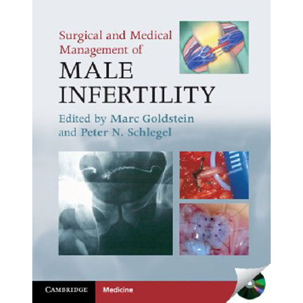 

Surgical and Medical Management of Male Infertility / Goldstein