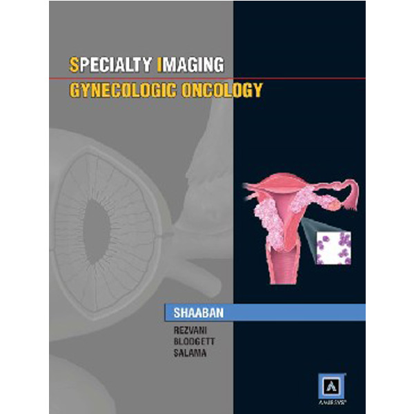 

Specialty Imaging™: Gynecologic Oncology: Published by Amirsys® / Shaaban