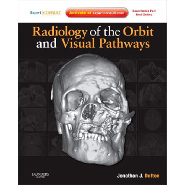 

Radiology of the Orbit and Visual Pathways / Jonathan J. Dutton