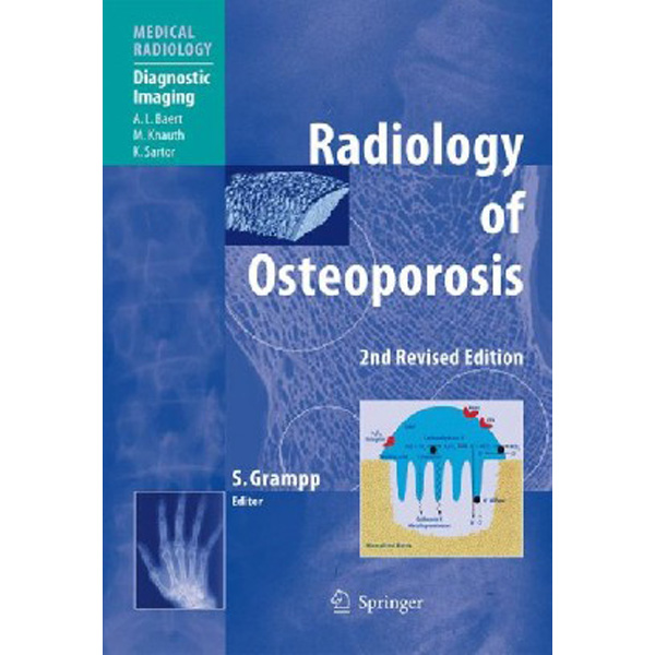 

Radiology of Osteoporosis / Grampp