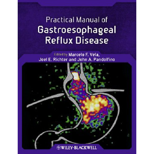 

Practical Manual of Gastroesophageal Reflux Disease / Vela