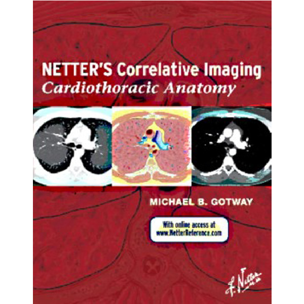 

Netter s Correlative Imaging: Cardiothoracic Anatomy, / Michael Gotway