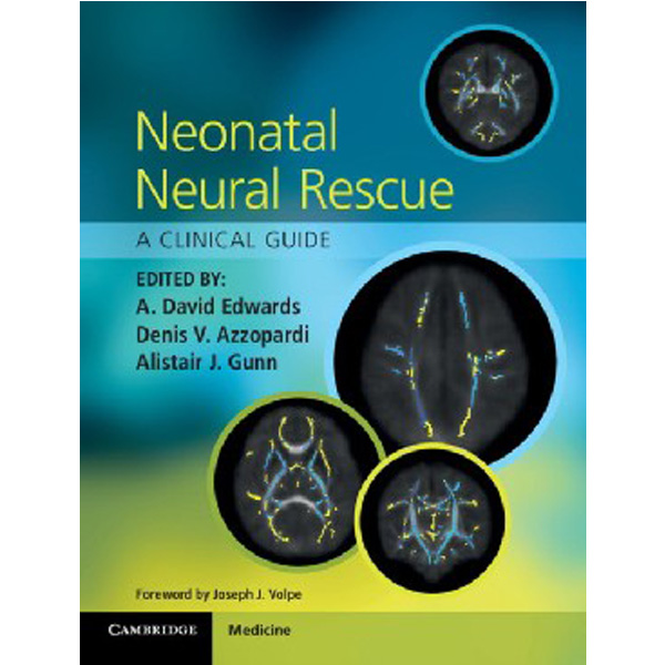 

Neonatal Neural Rescue / Edwards