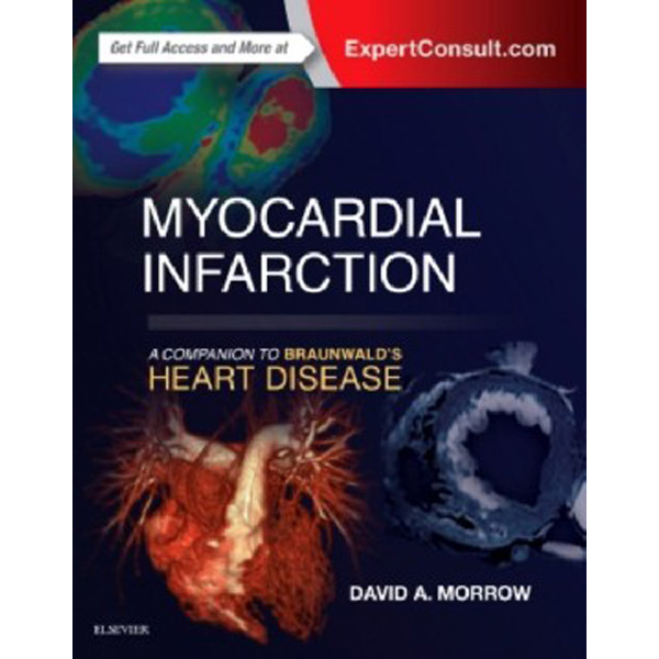 

Myocardial Infarction: A Companion to Braunwald's Heart Disease / Morrow David A